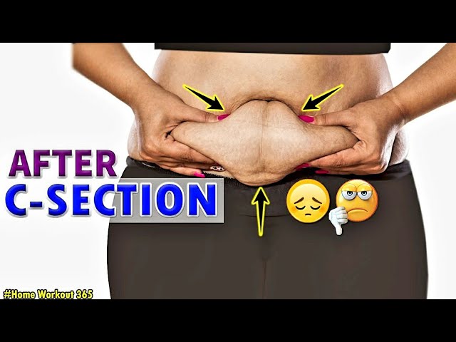 9 BEST EXERCISES TO DO AFTER C-SECTION | LOWER BELLY WORKOUT