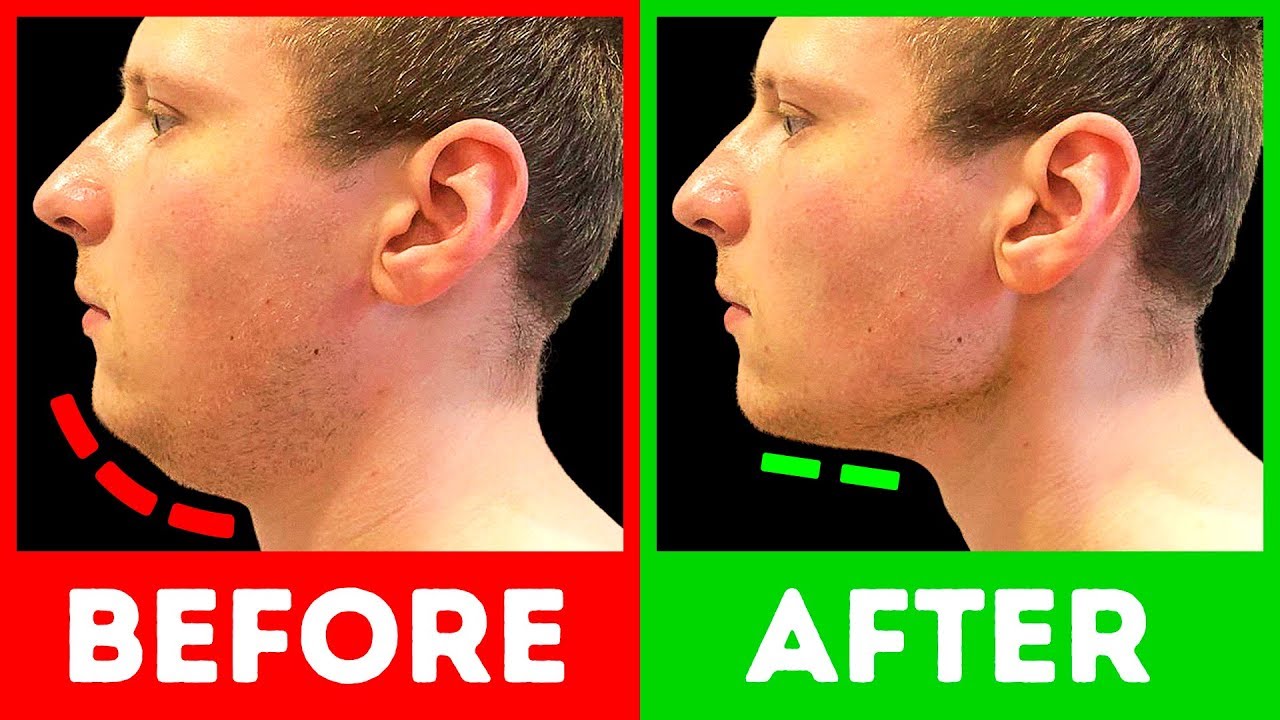 5-Minute Workout to Get Strong Defined Jawline for Men