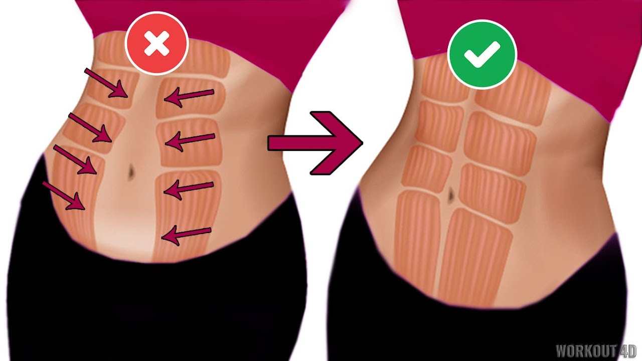 Fix Your Tummy... | Easy Diastasis Recti Workout